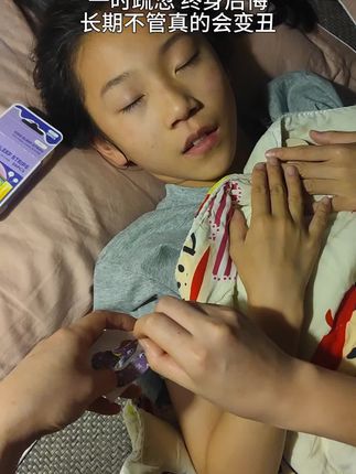 家长一定要引起注意,孩子张嘴睡觉是大忌!#张嘴睡觉会变丑 #闭嘴贴 #母婴好物 #打呼噜