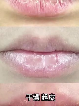 【宠粉专属】水蜜桃唇膜去死皮淡化唇纹保湿补水口红打底防干燥干裂#好物推荐🔥