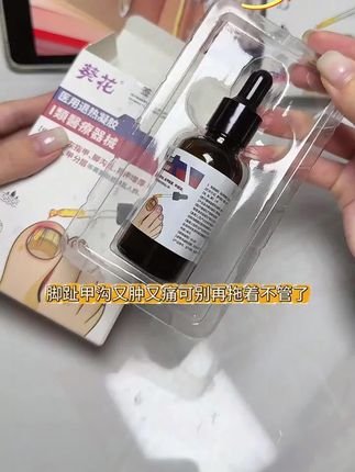 #灰指甲 #灰指甲凝胶 #灰指甲膏药