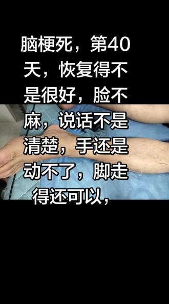邻居家价绍我们去一家诊所做针灸,说医生很神的,医生针灸很神很神的,结果我们我就马上去,这是等一天哦,明显有好转哦,医生说做一个疗程,未来的10天都是这样针灸,吊针,中药#治疗过程全记录 #