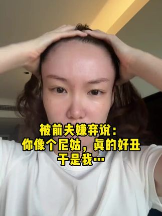 但凡我早点知道这个英国进口的贝尔士防脱固发洗发露,也不至于被头发大把大把掉困扰那么久!