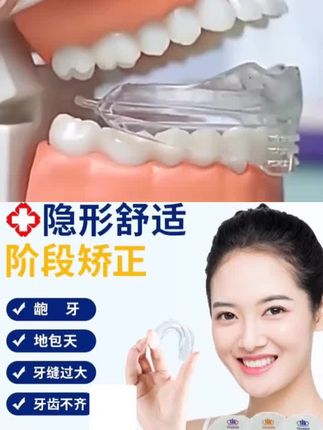 护齿牙套牙齿纠正器隐形龅牙门牙整牙地包天牙齿不齐矫形器矫正套#爱牙护牙 #牙齿健康 #你值得拥有美好的一切 #每日分享 #快来看看