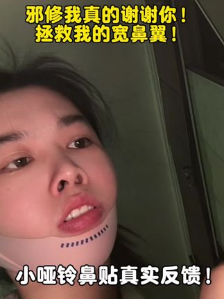 小哑铃鼻贴你是真的有点东西啊,一定要坚持,他就是利用物理加压的方式进行肌肉记忆,帮我们慢慢塑形,亲测有用!但是一定要认准正品啊,看到好多姐妹用了盗版鼻翼留胶,贴肤用的东西一定要选择质量好的!#张予曦#小哑铃鼻翼贴 #无限回购的宝藏单品 #亲测 #抽屉变装