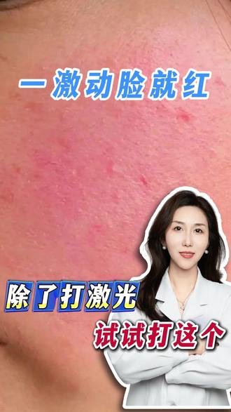 一激动脸就红 除了打激光 还可以试试打这个 #脸红 #抖出我的健康知识宝藏 #我的健康年度盘点