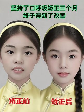 #口呼吸矫正 #张嘴睡觉怎么矫正 #张嘴睡觉矫正带 #口呼吸矫正带 #好物推荐🔥