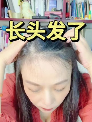 脱发头油头痒用用这把梳子 #掉头发 #头油头痒头屑有救了#清理毛囊的梳子 #创作者中心 #创作灵感