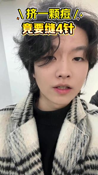 关凌挤痘致娃缝针 别拿孩子健康开玩笑