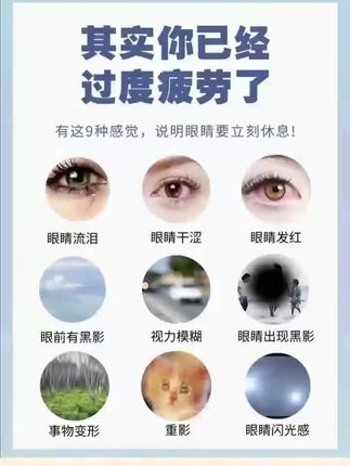 眼睛时不时模糊是什么原因 #眼睛 #视疲劳 #眼睛模糊 #眼睛模糊是什么原因 @抖音小助手 @DOU+小助手 @抖音媒体内容优推官 @抖音创作者大会