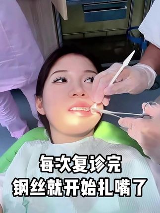 每次复诊后,钢丝都要扎嘴,还好都提前准备了这个#正畸蜡 #钢牙磨嘴 #钢牙妹 #口腔健康 #皓齿舒