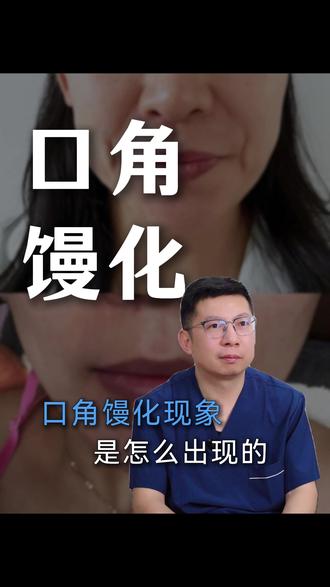 口角馒化是为什么? #华西李向东 #馒化修复李向东 #口角囊袋凸出 #馒化 #口角囊袋改善