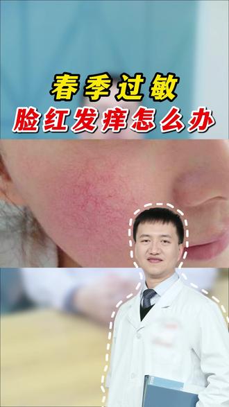 春季过敏脸红发痒怎么办?