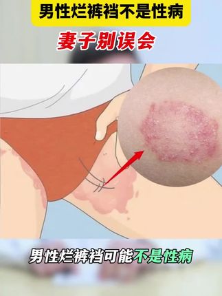 #超便宜超划算