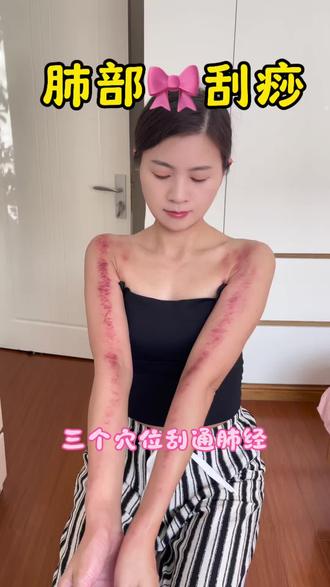肺部节节刮痧,三个重要穴位刮通肺经#肺结节#刮痧 #中医养生#养生知识