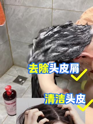 告别掉发烦恼,迎接浓密秀发的突破!#掉头发 #洗发水推荐 #头皮屑 #发型改变气质 #从头开始 @抖音小助手 @抖音创作小助手