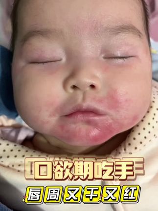 宝宝#口欲期 唇周一定要护理好,这款润本的#唇周膏 设计太贴心啦,45度角倾斜特别好抹开,避免口水二次结束#新生儿护理 #婴幼儿用品