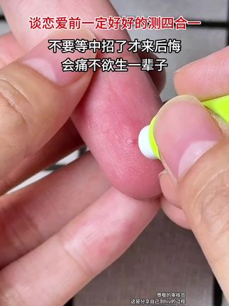 谈恋爱的至少要一起好好的测一次这个,四合一恋爱通行证,很多人不知道自己中招了又传给了身边人,不要等中招了再来后悔#谈恋爱 #异地恋 #情侣 #奔现 #感染四项