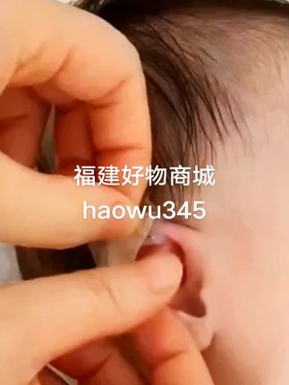 婴儿耳廓矫正器贴宝宝耳朵纠正器新生儿耳畸形矫形垂耳招风耳塑形#种草 #上热门 #创作灵感 #福建好物商城 @蛋蛋如意百货