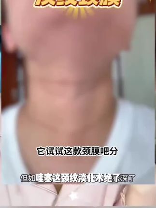 【金婧同款 到手20片】区颈纹淡化多肽淡纹颈膜紧致颈纹霜深度护理#祖国人表情包 #南号尚风头像 #皮卡丘头像 #磁场能量高的头像