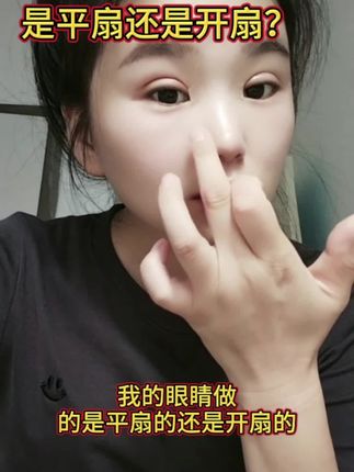 眼角增生了,眼角贴的是疤痕贴