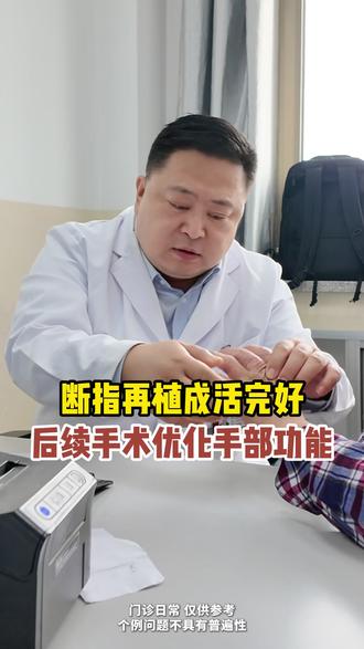 断指再植成活完好,后续手术优化手部功能 #断指再造 #手指再造郝丽文 #门诊日常