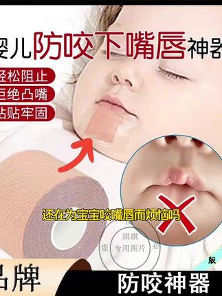 婴儿防咬嘴唇矫正贴儿童睡觉戒咬