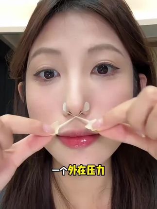 我的蒜头鼻有救了,予曦你是我的神!#蒜头鼻 #鼻翼贴 #逆袭 #鼻翼大