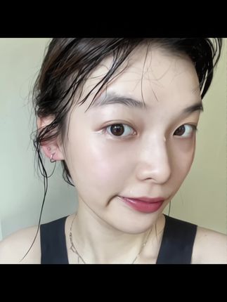 幸好听了妈妈的话…每晚贴一贴,困顿油腻豆豆都在消失了