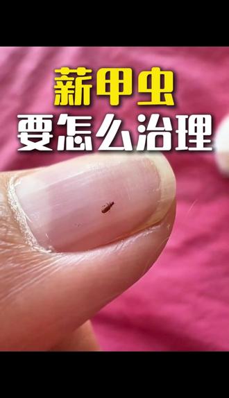 薪甲虫要怎么治理 这种半个芝麻大小、长约 1 毫米的淡黄色小虫,就是薪甲虫。它们多在墙角、门框、窗台出现,常扎堆行动,速度缓慢。
家中出现薪甲虫,通常是因为有漏水渗水情况,木制品、墙纸受潮发霉后,便会滋生这类虫子,且其繁殖速度极快,半年内可发展到上万只规模。
治理薪甲虫,可用这款杀虫剂:将药剂喷入受潮的木制品缝隙,同时在周围区域喷洒形成杀虫药带,虫子接触即死亡,3 天喷一次,连续使用两周即可。该药剂无色无味,使用后无痕迹,不影响正常居住;同时需对发霉处做除霉处理,清除薪甲虫的食物源,彻底杜绝滋生。
#薪甲虫 #霉虫 #薪甲虫专用杀虫剂 #薪甲虫如何消灭 #1毫米黄色小虫