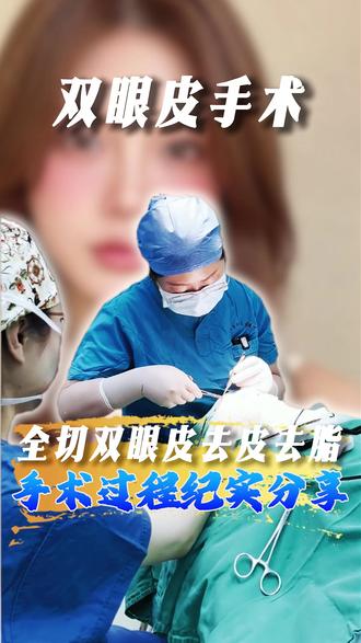 双眼皮手术去皮去脂过程记录分享 #双眼皮 #北京双眼皮 #双眼皮手术