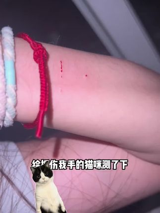 狂犬其实并不可怕,我们都被骗了!#新手养猫 #萌宠好物 #新手养狗 #狂犬病毒 #养猫经验分享