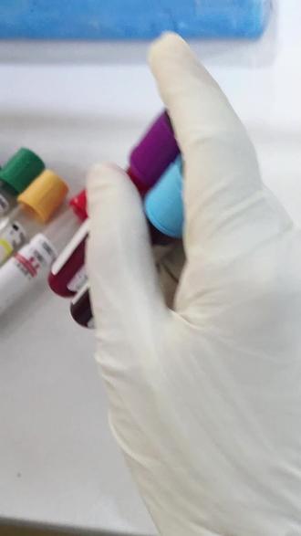 抽血是为什么需要那么多颜色的管子,为什么抽血前管子需要摇一摇。#检验科日常工作 #抽血检验 #抽血