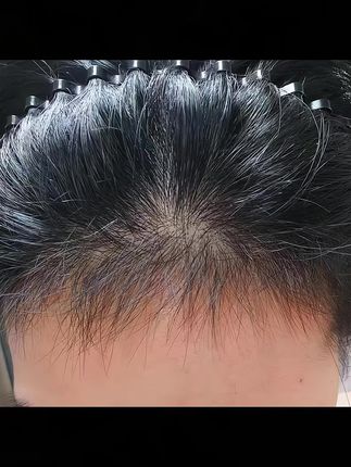 真的没想到被妈妈反向种草了!坚持用皂洗了一段时间后,我都快成四千年了!#养发护发 #洗护好物 #洗发皂
