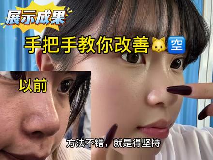 1️⃣🧑🎓教你过年前如何🆘补救缩(毛孔)#毛孔#元旦#中医#变美逆袭#缩毛孔