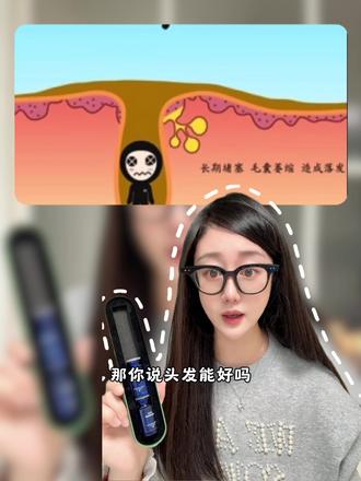 雄脱、孕哺期、皮炎敏感肌安心用的精华来了
小蓝瓶VS小银瓶怎么选?听我唠唠
#雄脱 #禾蛮满 #脂溢性掉发 #脂溢性毛囊炎 #头痒头油怎么解决 (AI生成只因用了个语音包,其余都是真人测评哈)