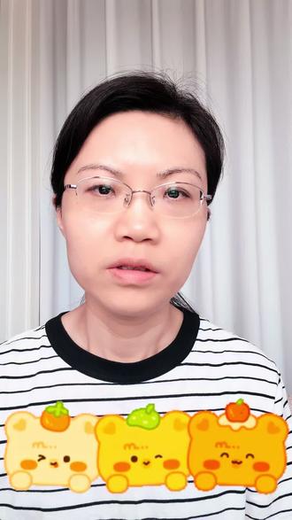 孩子斑秃是什么原因?为什么容易复发?怎么治疗? #斑秃#鬼剃头#儿童#掉发#芜湖