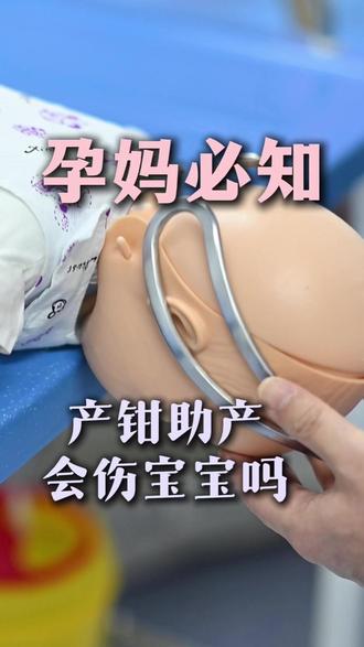 顺产用产钳,宝宝到底遭不遭罪?产科医生说实话 #顺产 #产钳 #生孩子 #科普