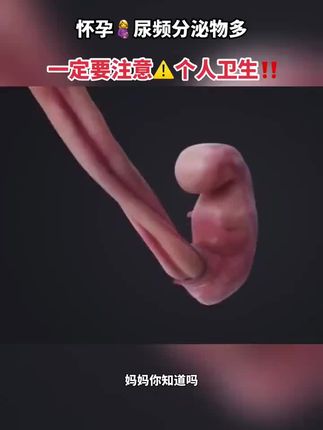 怀孕🤰后分泌物越来越多,一天跑几百次厕所入了便携#湿厕纸,每次用它干净又清爽,孕期姐妹一定要准备湿厕纸,注意个人卫生#孕期#孕期囤货  #孕期知识#产检一路绿灯
