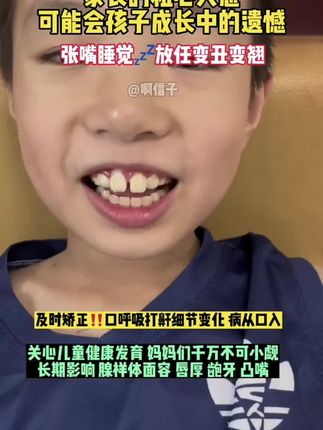 我儿子要是从小就贴这个,也不会因为嘴形而担心。#张嘴呼吸会变丑 #闭嘴贴 #嘴凸 #打呼噜 #亲测分享