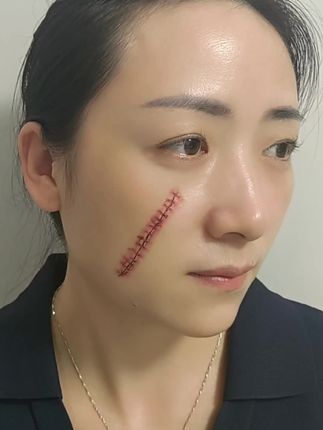 有些伤表面看似愈合,其实是扎在心里一辈子的刺#防水防汗纹身贴纸#伤疤纹身贴#纹身贴