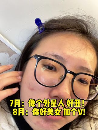 邪修护肤还得看老祖宗,玉肌散坚持下来真的牛!#玉肌散 #黑头 #护肤