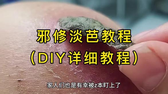 手把手教你20s学会邪修🥚芭小技巧#淡疤#剖腹产#产后护理#zocc疤痕凝胶