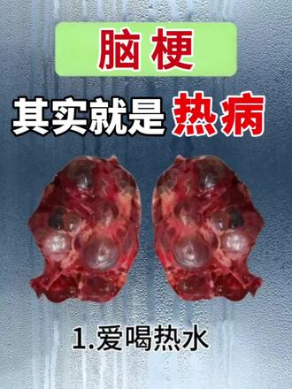 #脑梗#脑梗塞#RedHalo脑力源胶囊#脑梗#脑梗塞#RedHalo脑力源胶囊