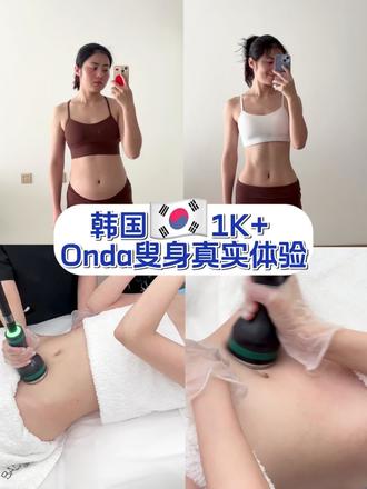 韩国1000+Onda真实体验!分享一下 #韩国 #变美 #韩国do脸 #变美好去处 #韩国皮肤科