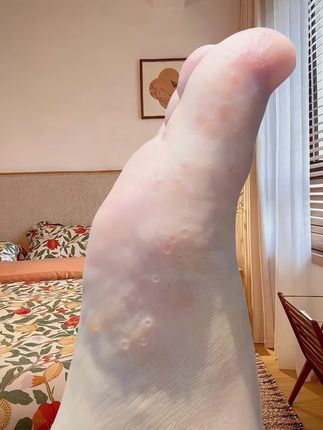 终于不痒不臭了,太好了!老牌子用着真滴很放心呀#万万没想到#无处安放的小脚丫#足部护理#无处安放的小脚丫