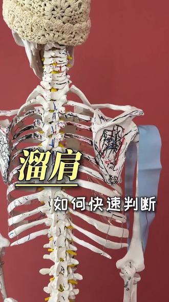 如何快速判断溜肩 #瑜伽#科普#溜肩#解剖#栗子瑜伽