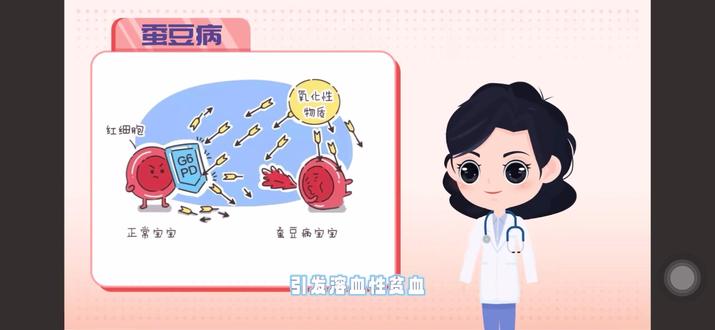 (G6PD)蚕豆病这个和我们的性别有关,因为他存在于X染色体上,女性有两个X染色体,但是男性只有一个。所以如果女性携带了相关基因,是不患病的,只是携带了一个这个疾病的基因。但是有50%可能遗传给小孩,如果是儿子,就有50%可能患病,如果是女儿,则和自己一样不会患病但是可能会遗传下去。#蚕豆病 #x连锁遗传
