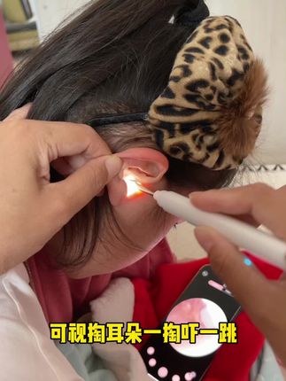 可视掏耳勺,自带高清摄像头,清理耳道真解压,通过手机就可以看到耳朵里面的污垢,充电式设计,爱了爱了 #可视掏耳勺
