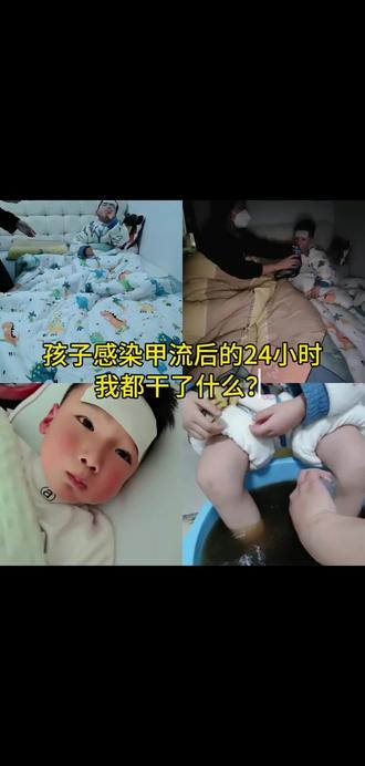 这一次甲流我总结了几个经验:第一,如果孩子高烧不退,刚开始一两天有时是测不出来甲流阳性的,只要头疼头晕,咳嗽,体温超过39°不退,有的还会出现恶心呕吐,腹泻的症状,请不要犹豫,基本可以断定为中招了,这些都是流感的症状,48小时黄金时间内大家一定要吃上抗流感药物。
第二,不要一发烧就上抗生素,医生很明确的告诉我,现在很多孩子已经对阿奇耐药了,就是因为家长在家擅自吃擅自停,造成了抗生素的耐药性,而且抗生素对病毒是无效的。
第三,甲流的传染性是极强的,家里一旦有一个人中招,剩下的人一定要及时的隔离到其他房间,戴口罩,多通风多喝水,保持充足睡眠,一定不要熬夜。
最后就是一定要等到孩子退烧后的48小时再去学校复课,真的求求了,有些家长上午带孩子看完病,下午就返校上课,别图那一时轻松,想着问题不大,回头把整个班级都传染了。这条视频,希望你永远都用不到#亲子互动 #甲流 #发烧 #日常vlog #每日分享
