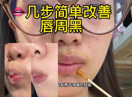 有唇周黑的宝宝进来抄作业!! #唇周黑#嘴角暗沉#护肤教程#大学生记录生活