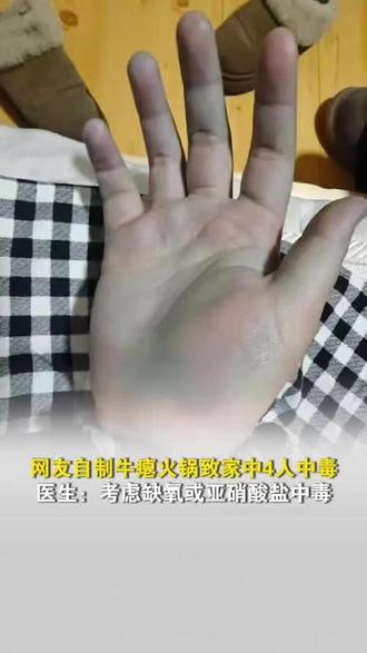 网友自制牛瘪火锅致家中4人中毒,双手发蓝成“蓝精灵”,出现头晕症状,医生:考虑缺氧或亚硝酸盐中毒,#冬天烤火致一氧化碳中毒也会皮肤变红 #牛瘪火锅 #食物中毒